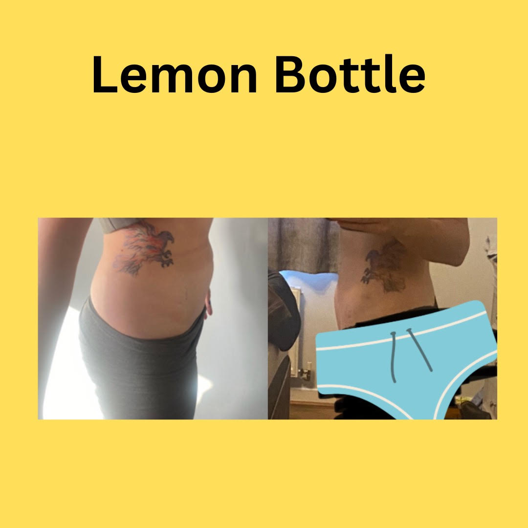 OUT OF STOCK PREORDER ONLY - delivery date unknown. 
Lemon Bottle Fat Dissolver 5x10ml box